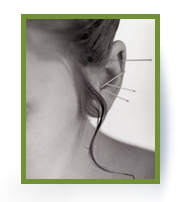 auriculoterapia